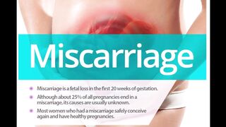 Miscarriage symptoms, causes, diagnosis & treatment