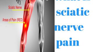 Sciatica pain |sciatic nerve pain kiya hota hai|Urdu| hindi