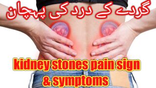 Kidney stones pain sign and symptoms