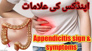 Appendicitis pain sign and symptoms
