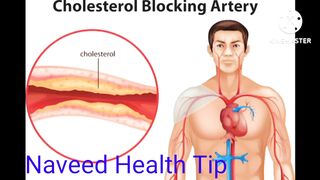 Cholesterol (lipids profile) hdl.ldl.Naveedhealth..