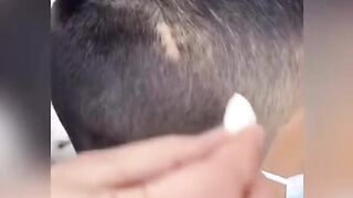 How to treat hair loss