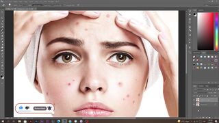 Remove Acne And Skin Blemishes In Photoshop Using The Spot Healing Brush