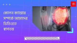 The 5 most common colon cancer symptoms you must know