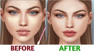 ASMR treatment for allergic lips caused by eating poisonous mushrooms