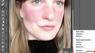 How to Remove Red Patches on Face