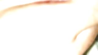 Cat Wounds tiktok julietmbinder