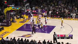 Anthony Davis is the king of falling over and almost having a career-ending injury every single game