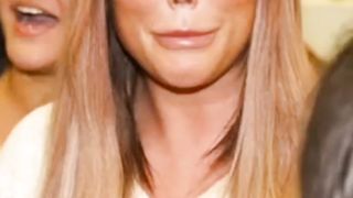 Wrost plastic surgery
