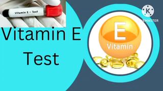 Cholesterol ( lipids profile) hdl,ldl,vldl, Naveedhealth,,