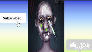 ASMR Blackhead removal collection and treatment to remove secretions caused at eyes, nose , head/ Malikgamehealth/ Pakistan/ game videos.