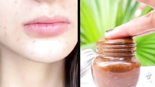 Pigmentation removal cream..