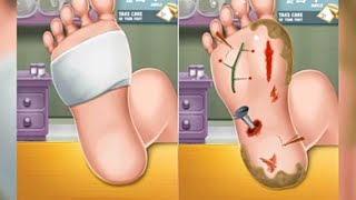 ASMR Foot Care Treatment | ASMR Remove Fungal Infection | 더위 조심! 사실적인 내성발톱 케어 애니메이션