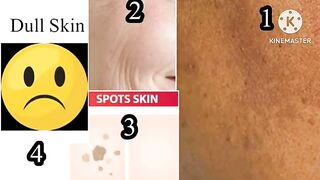 Wars benefits for skin. Skin whitening remedy