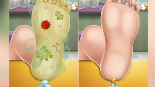 ASMR | Foot Care | Remove Fungal Infection | Plantar Warts Animation | 더위 조심! 사실적인 내성발톱 케어 애니메이션