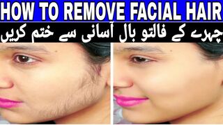 How to remove facial hair in urdu || Hair on face in females || چہرے کے فالتو بال کیسے ختم کریں۔