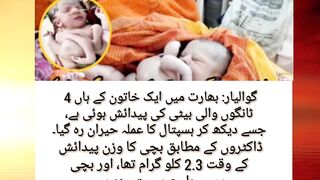Abnormal baby girl birth | four legs girl | daddah