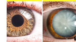 Camera Vs eye on mega peksis amazing facts video