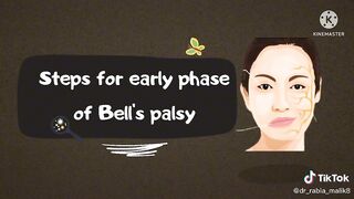 bells palsy