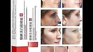 20g Effective Whitening Freckle Cream Remove Acne Dark Spot