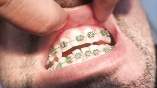Teeth making
