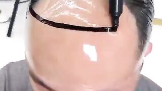 Hair growth treatment