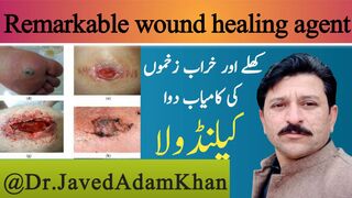Calandola, best medicine for open wounds. JAVEDKHAN12485
