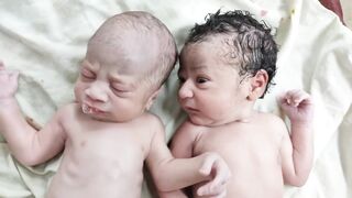 Twin baby crying