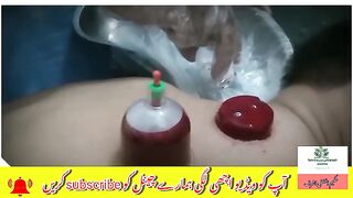 hijama cupping therapy benefits