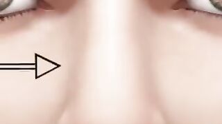 How_Nose_Surgery_Works_(3D_Animation)_#shorts