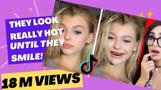 They're looking Really Hot Until they Smile (Tik Tok Compilation)