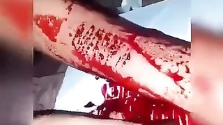 ????????