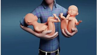 How to make twins