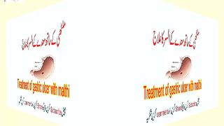 Treatment of gastric ulcer with malthi