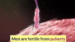 Infertility in humans