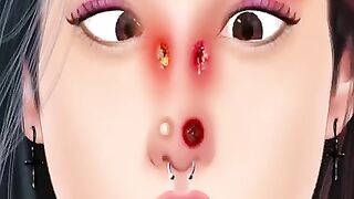 Asmar nose treatment