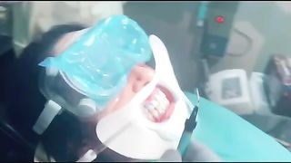 laser teeth whitening