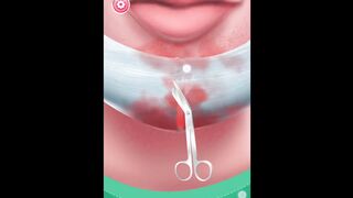 ASMR chin wound