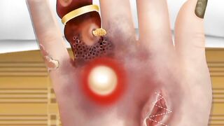 [ASMR] Hand ✋ Fungus Treatment ASMR sounds animation