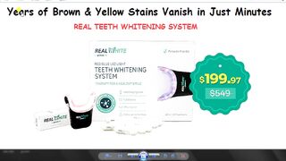 Real Teeth Whitening System Visit the link in description below