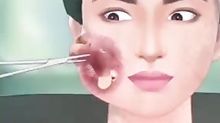 Face injury