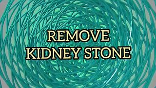 #Febspot #Video Ab KIDNEY STONE Se Chutkara Without Operation
