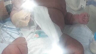 Newborn healthy baby admitted in nicu