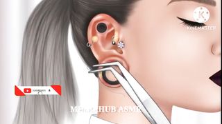 ASMR Cleaning 22mm ear gauge hole swollen for lady | Removal animation