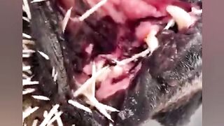 Superb Video may you like this plz don't watch the weaken heart or patient people ????????