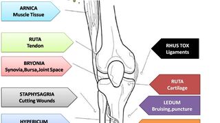 Homeopathic Bone Specialist  By DR BABAR AMIN
