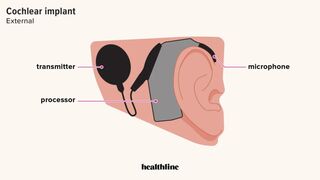 {ASMR} Ear Surgery
