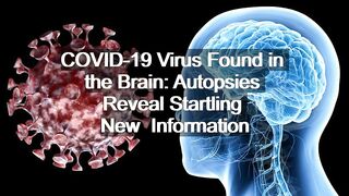 COVID-19 Virus Found in the Brain: Autopsies Reveal Startling New  Information | Sci-Tech News |