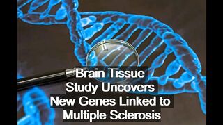 Brain Tissue Study Uncovers New Genes Linked to Multiple Sclerosis | Sci-Tech News |