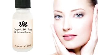 Organic Tags Solutions Serum No Skin Tag Remover  Mole Removal Cream Painless Face
